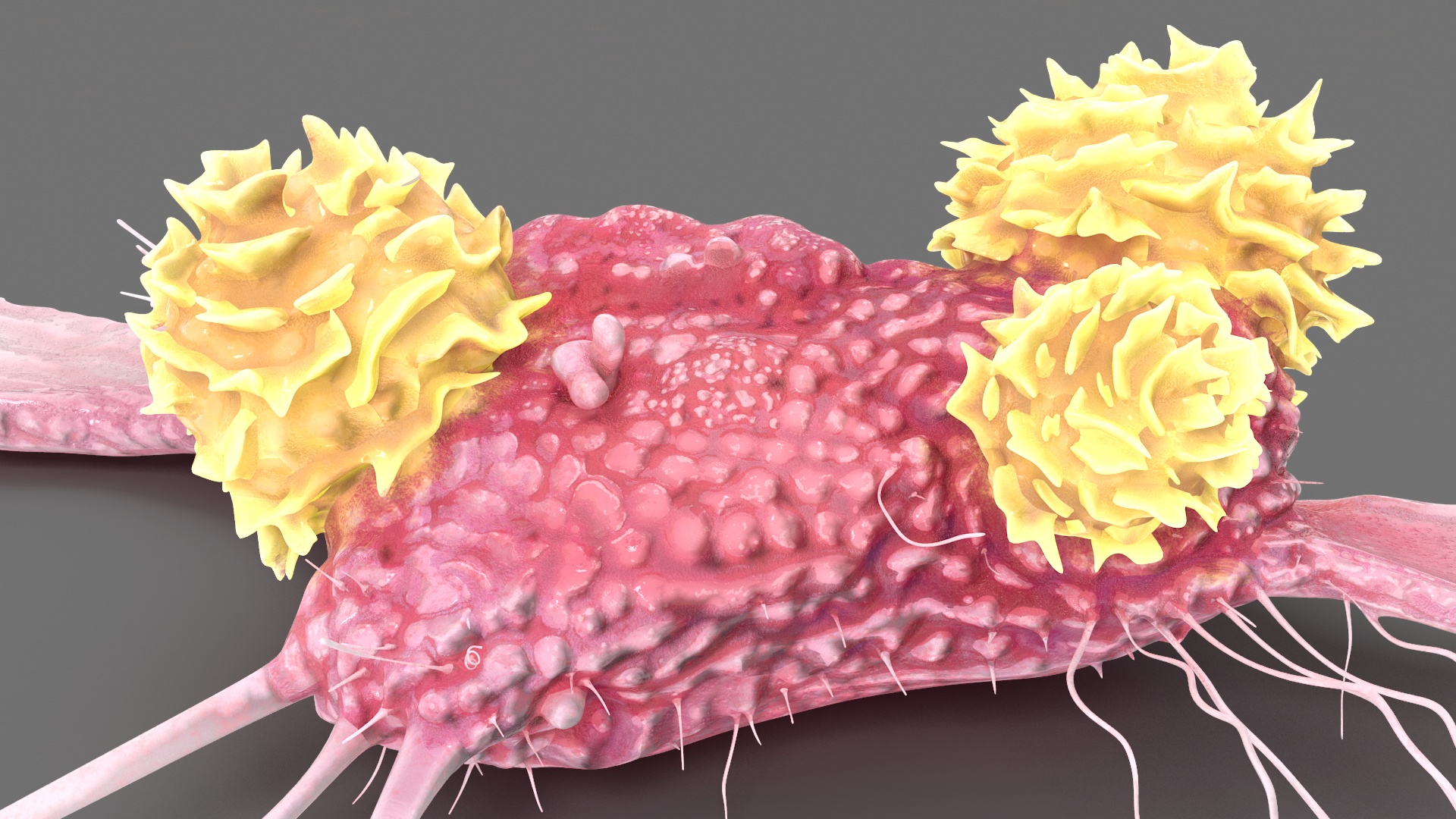 3D model Cancer Cell with 3 Lymphocytes