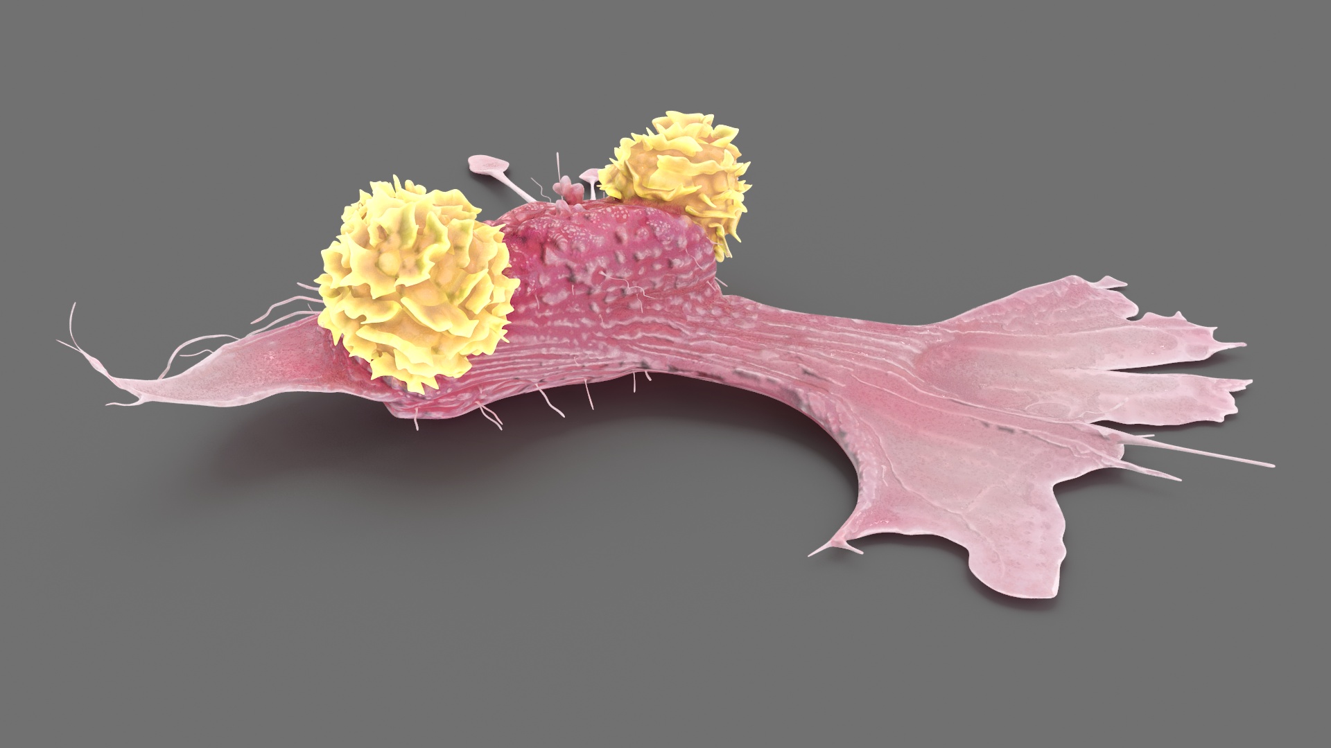 3D model Cancer Cell with 3 Lymphocytes