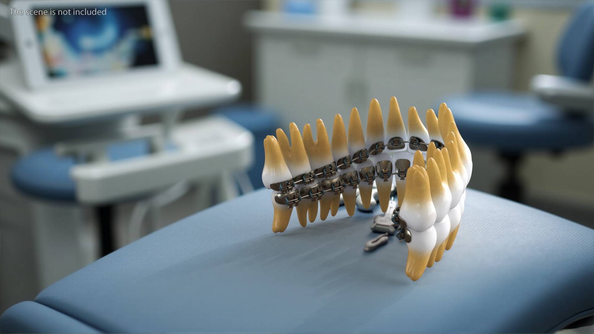 3D Lingual Braces on Teeth model