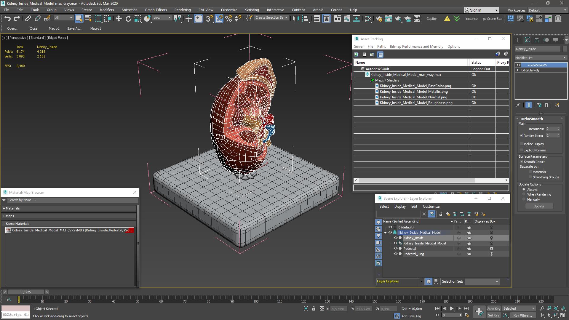 Kidney Inside Medical Model 3D