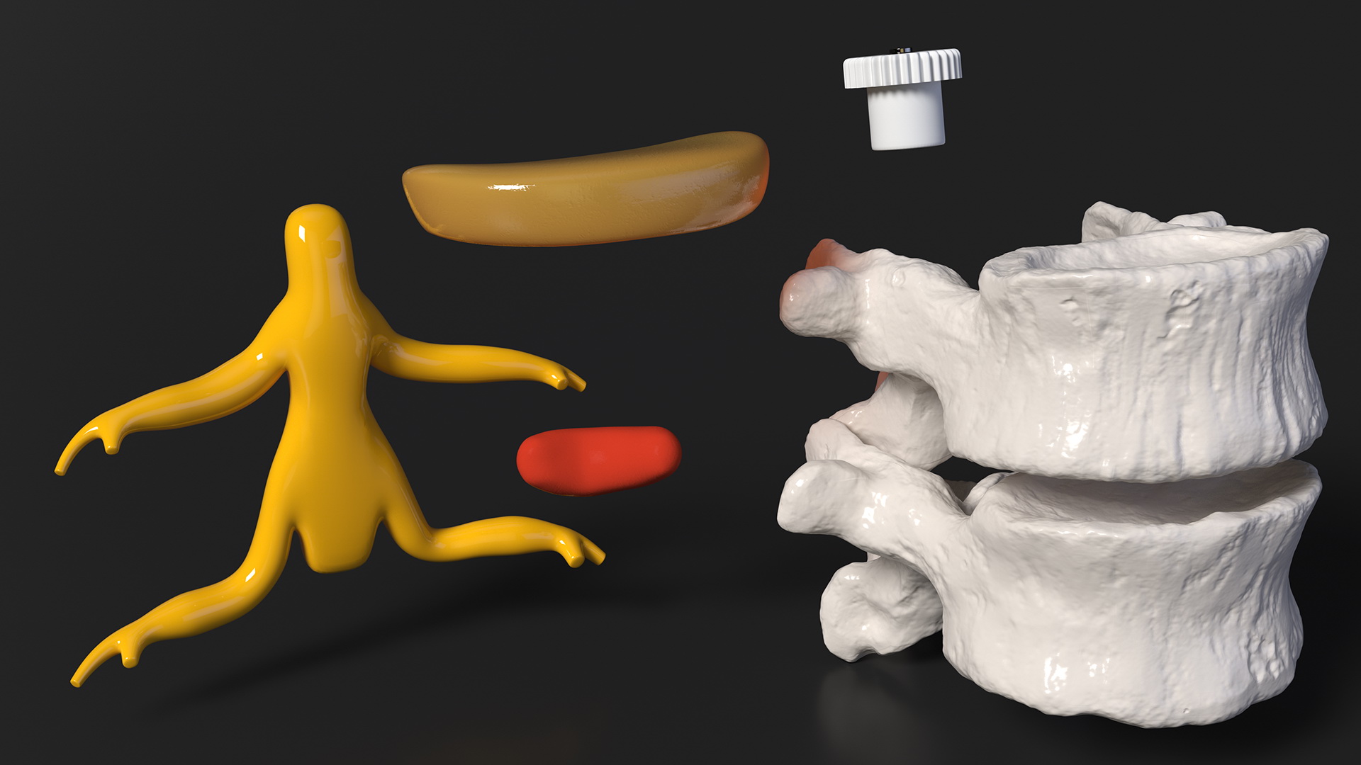 3D Part of Spinal Column with Hernia model