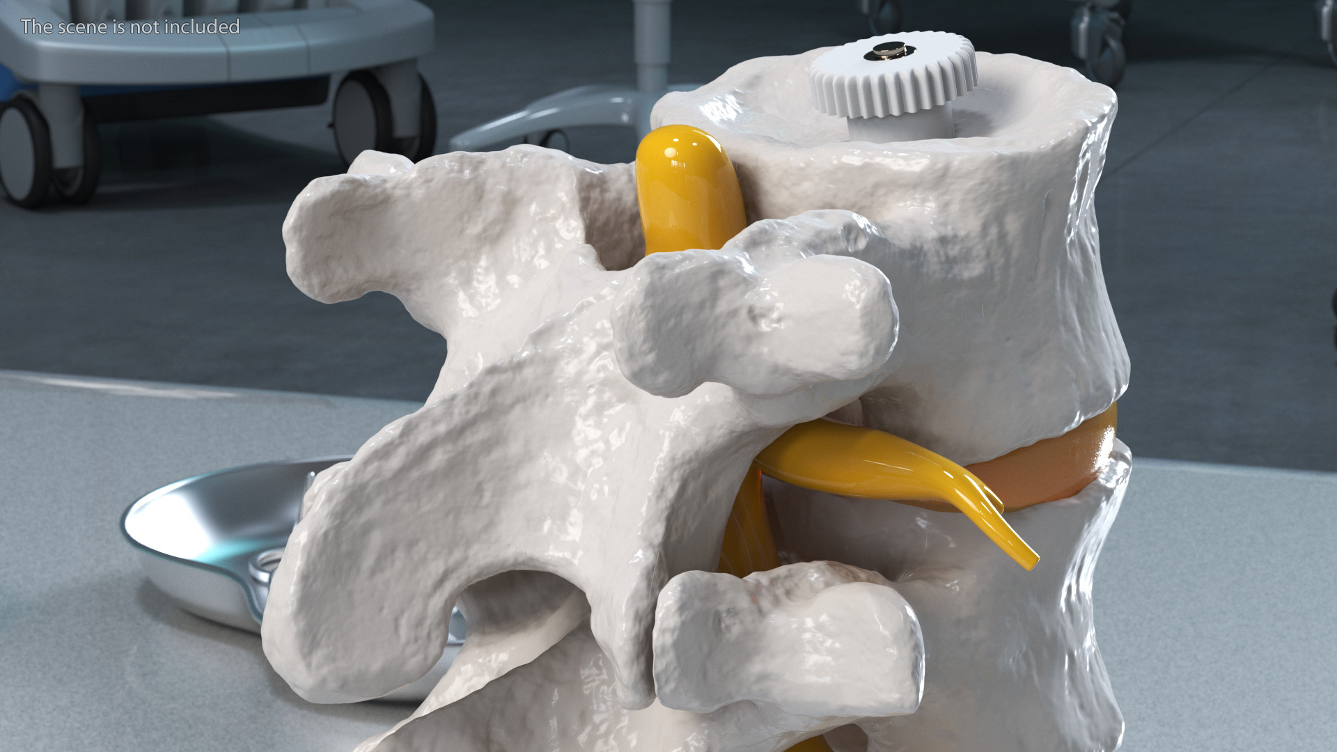 3D Part of Spinal Column with Hernia model