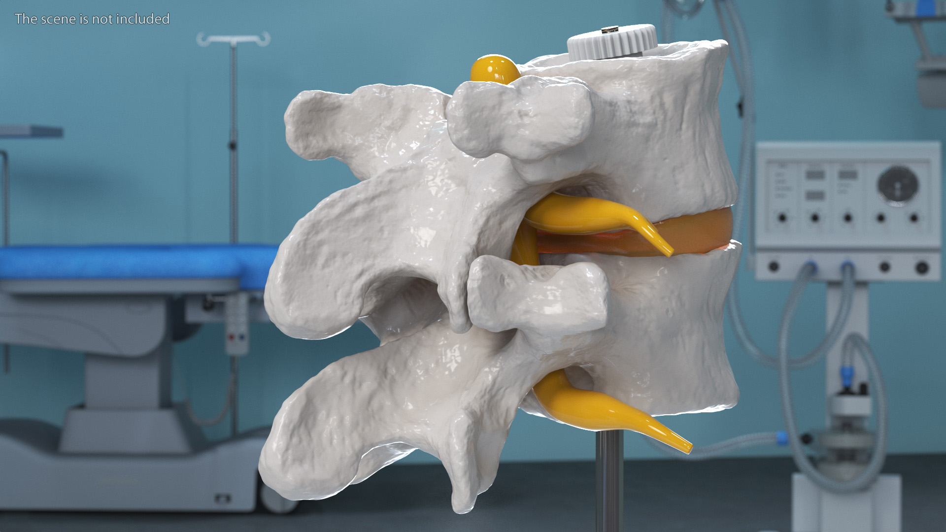 3D Part of Spinal Column with Hernia model