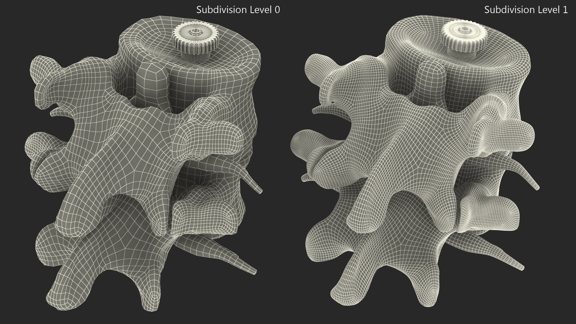 3D Part of Spinal Column with Hernia model