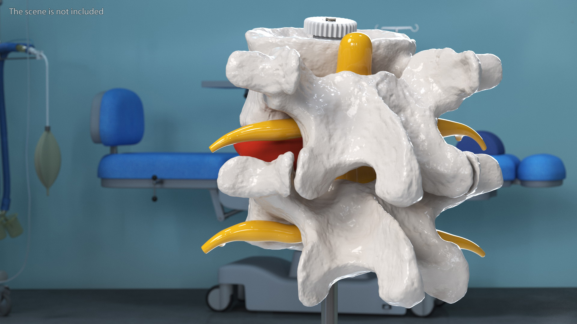 3D Part of Spinal Column with Hernia model