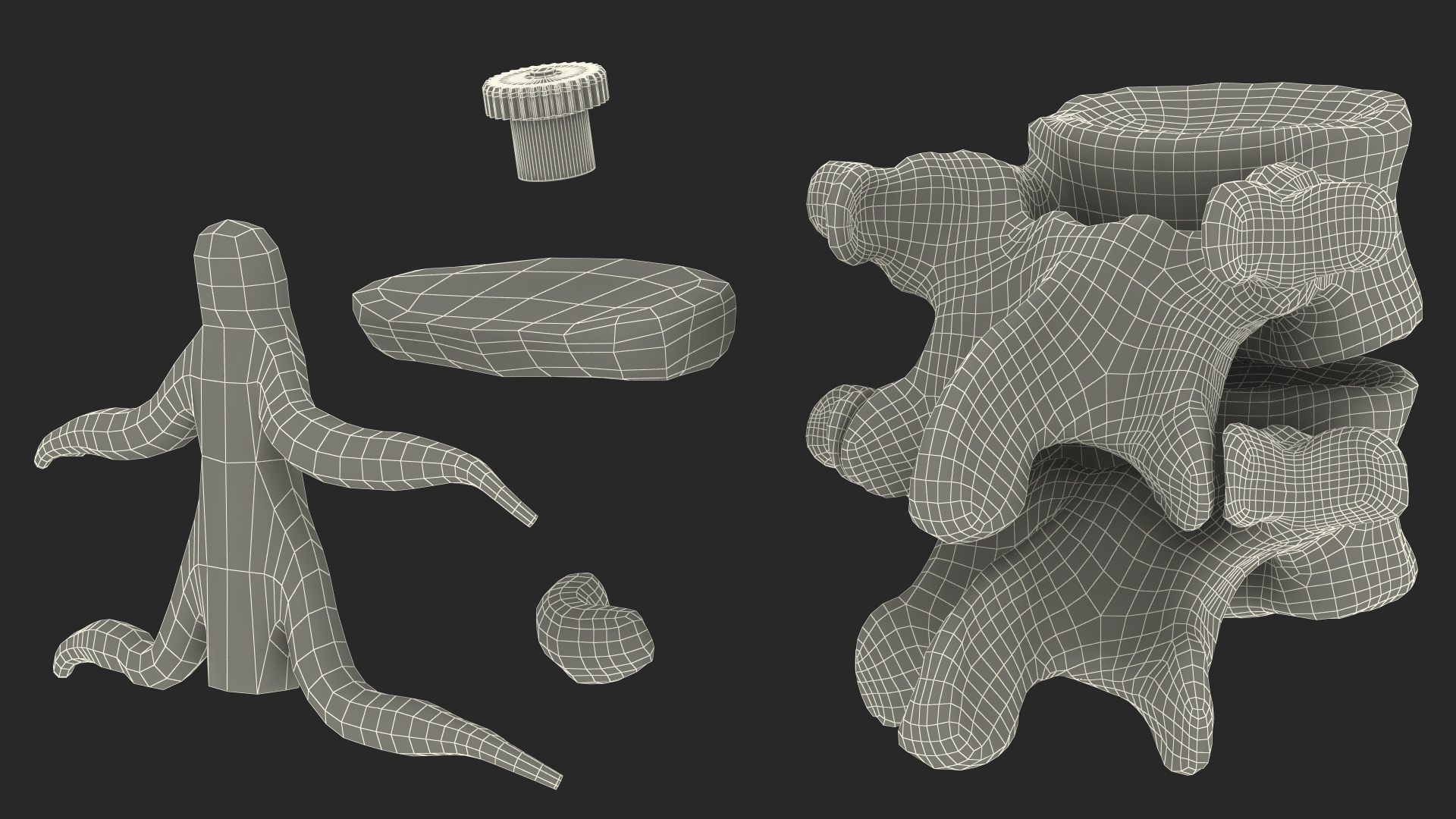 3D Part of Spinal Column with Hernia model