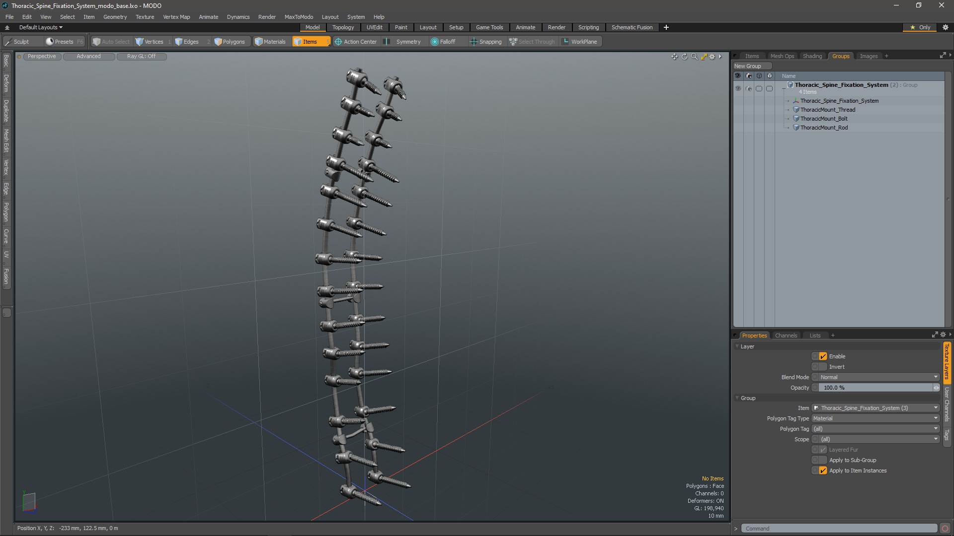 3D model Thoracic Spine Fixation System