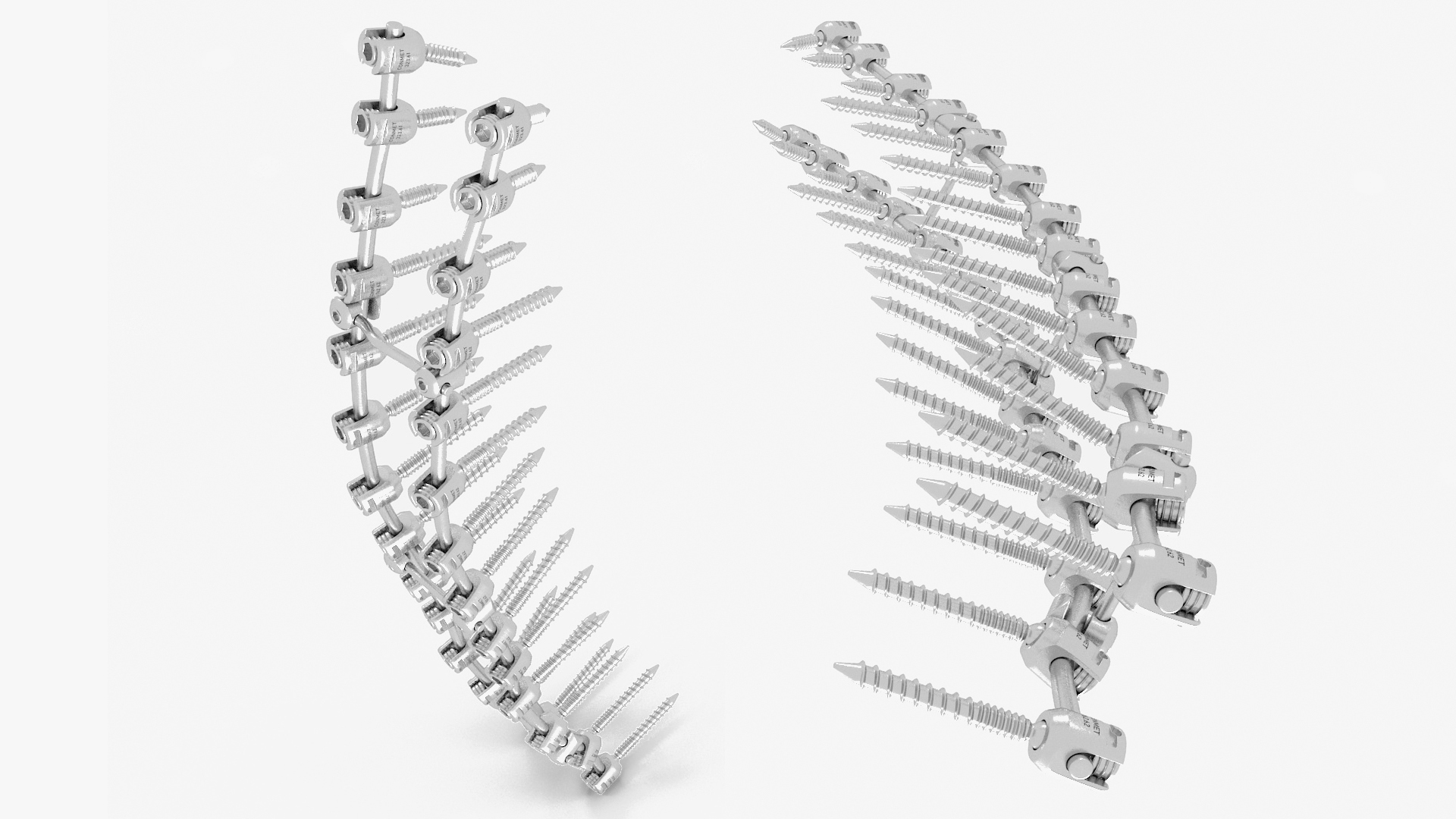 3D model Thoracic Spine Fixation System