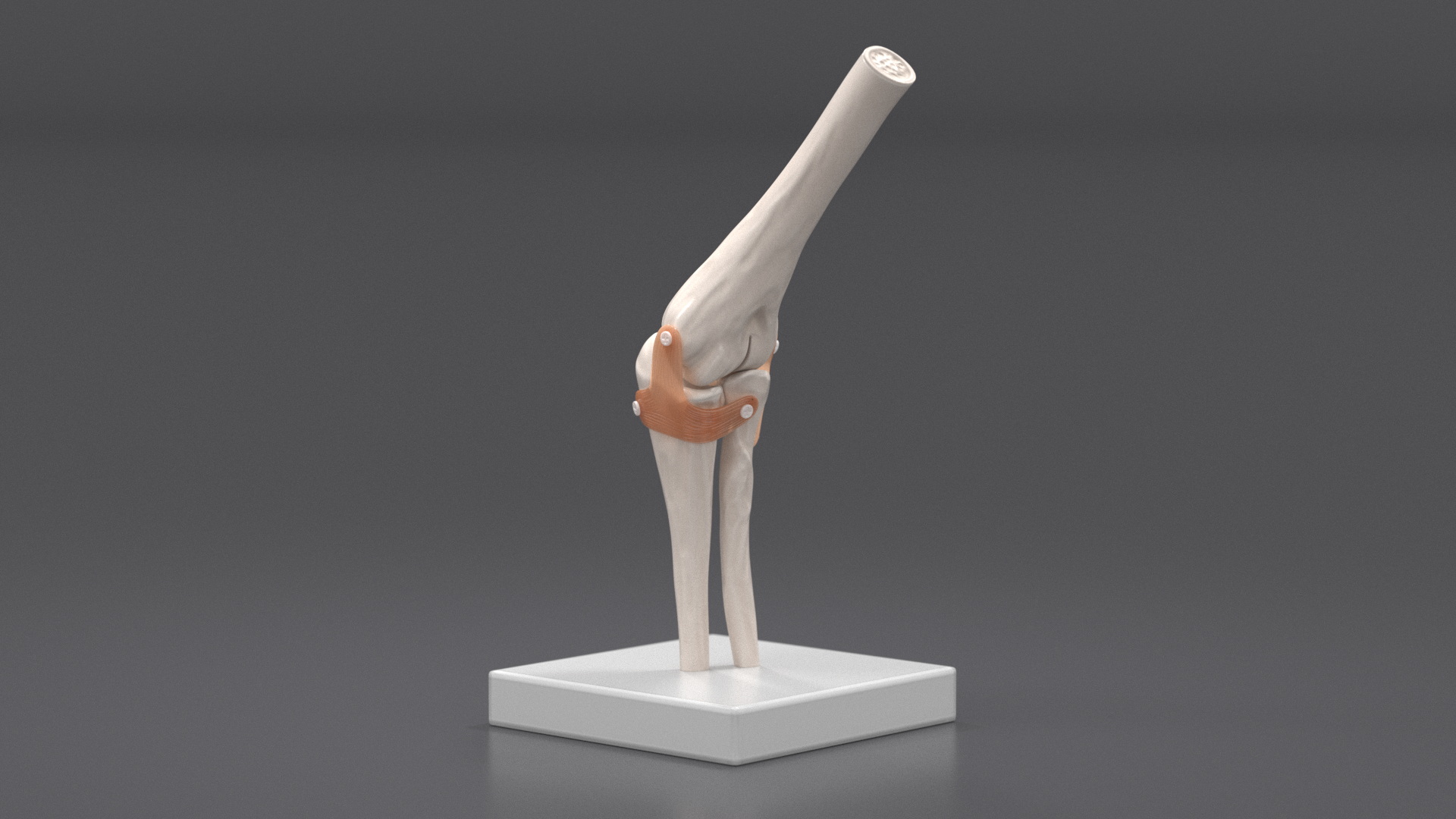 3D Elbow Joint