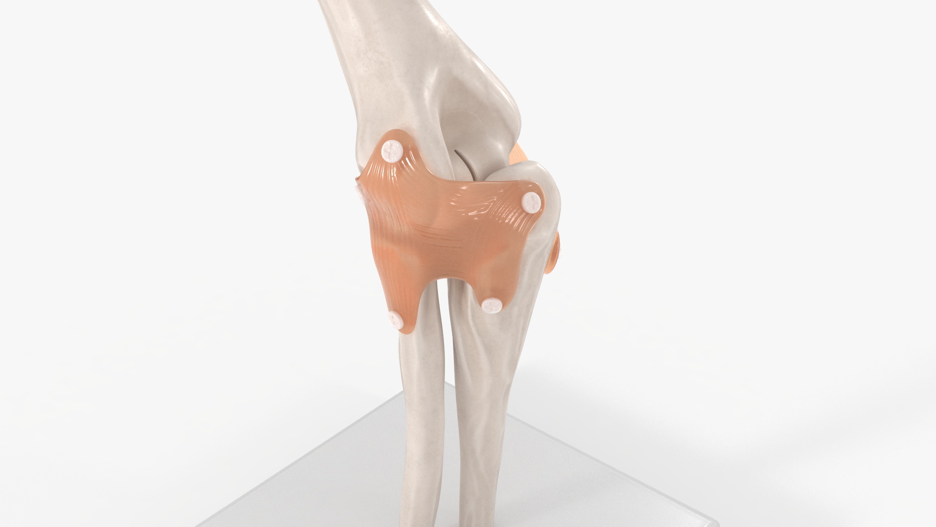 3D Elbow Joint