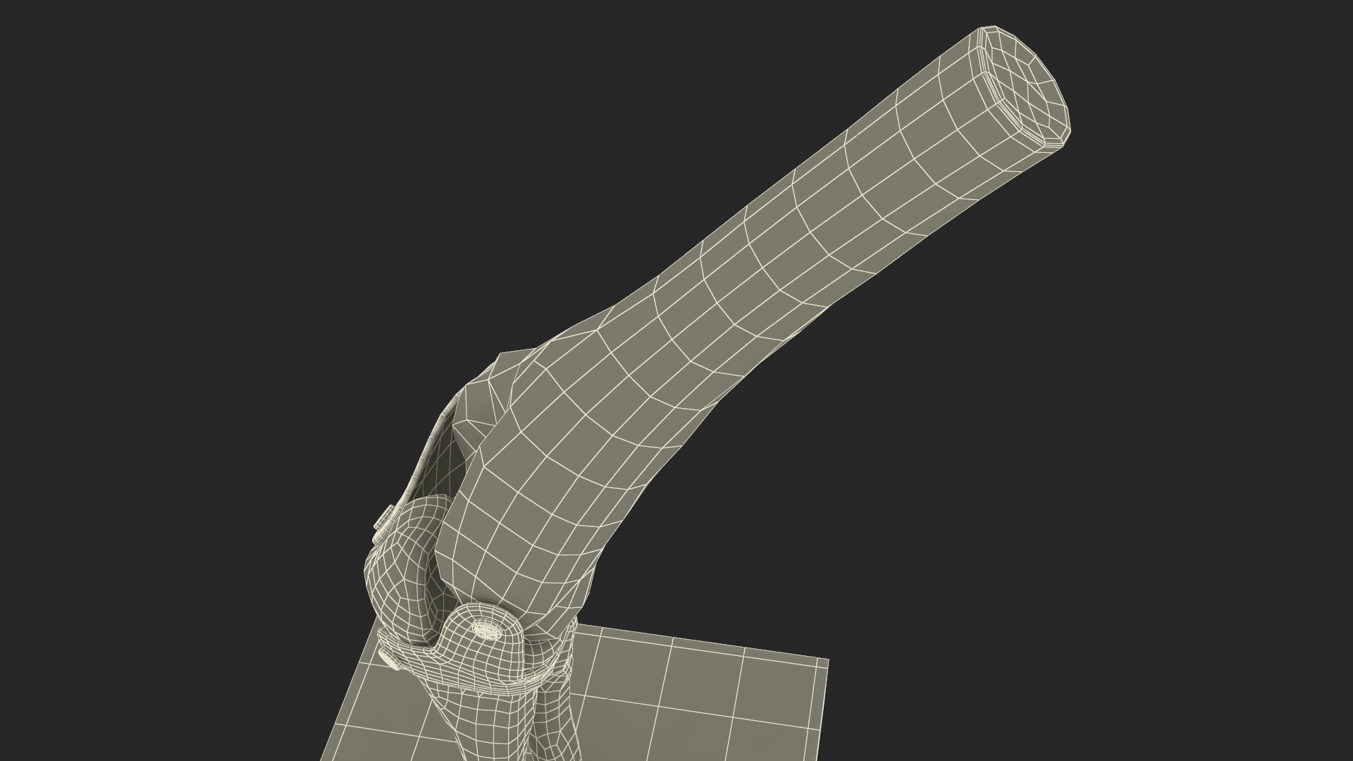 3D Elbow Joint