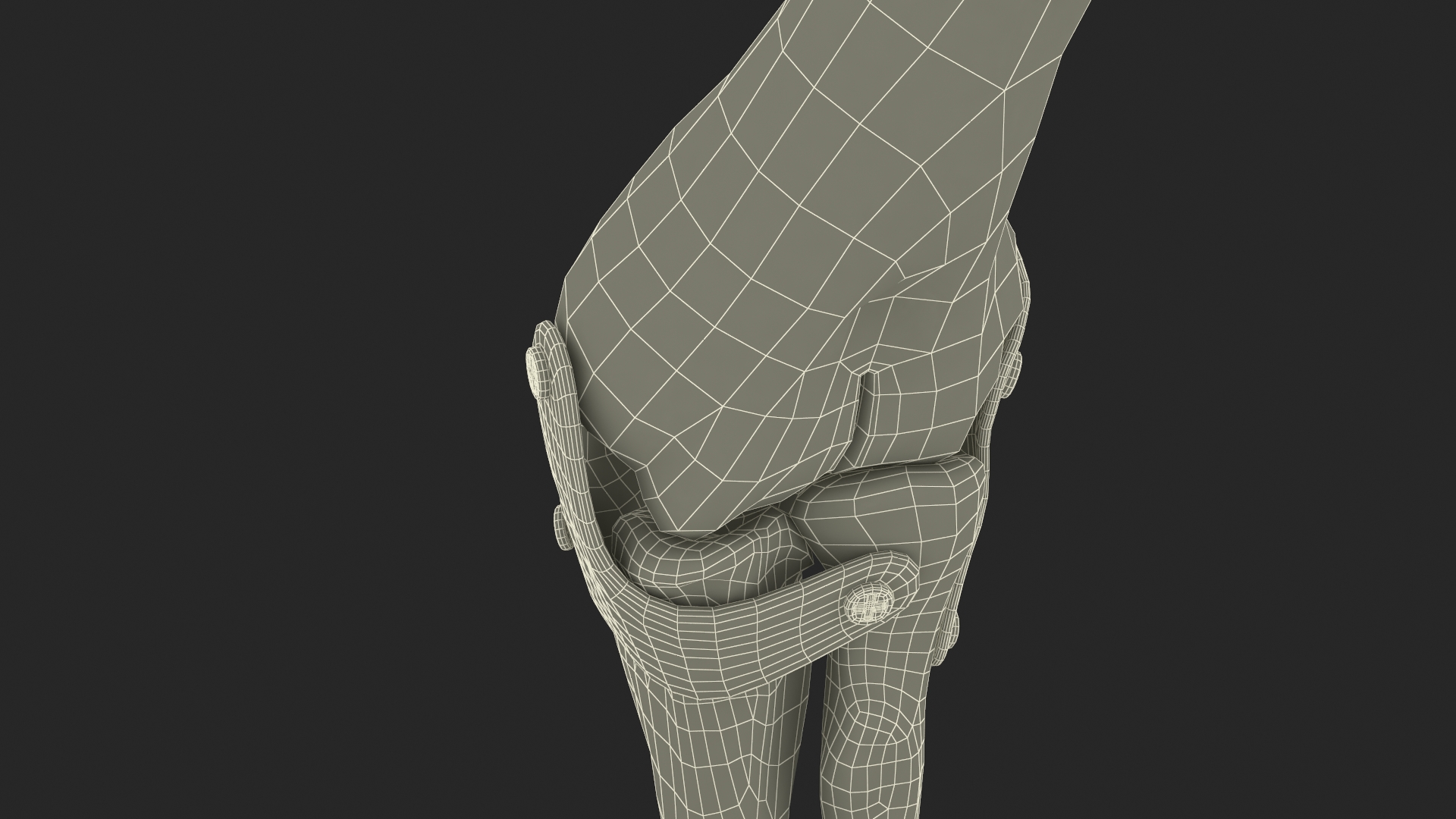 3D Elbow Joint