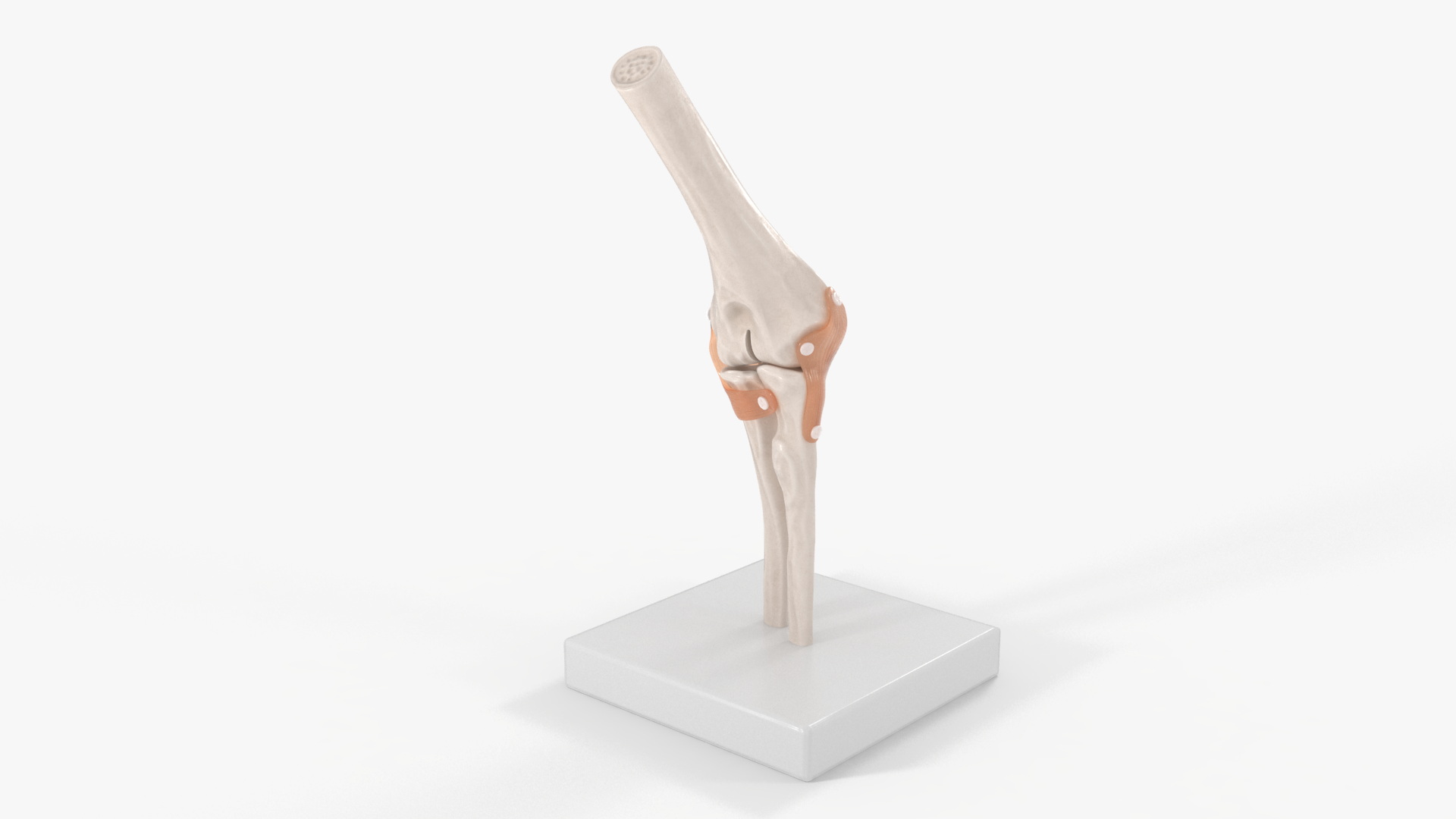 3D Elbow Joint