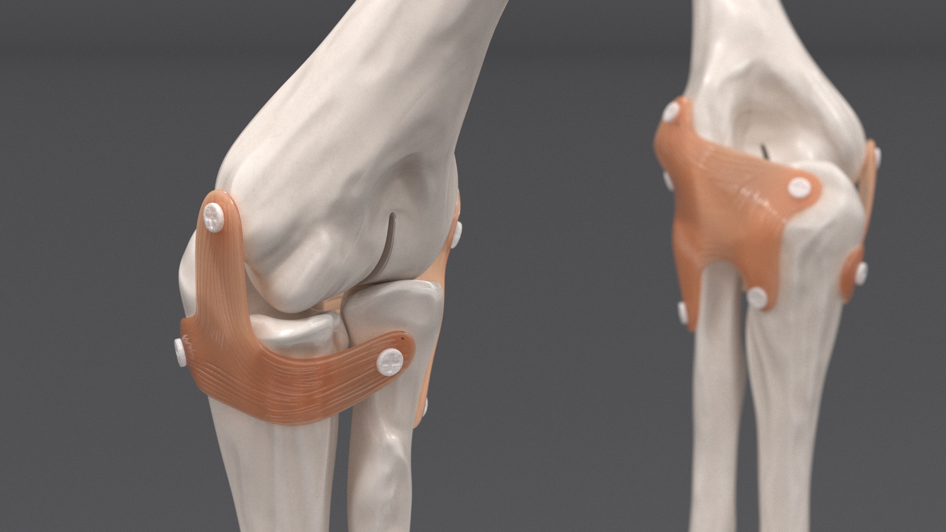 3D Elbow Joint