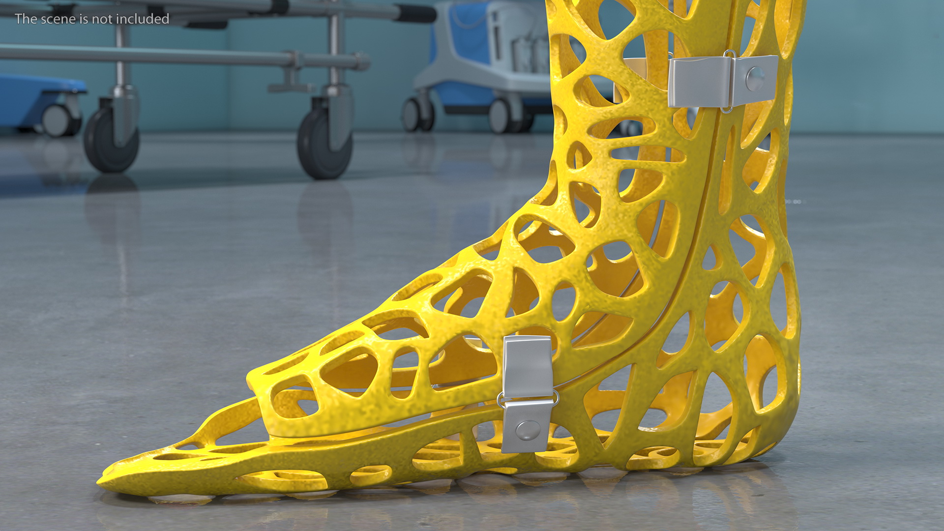 3D-Printed Orthopedic Cast Leg Yellow 3D