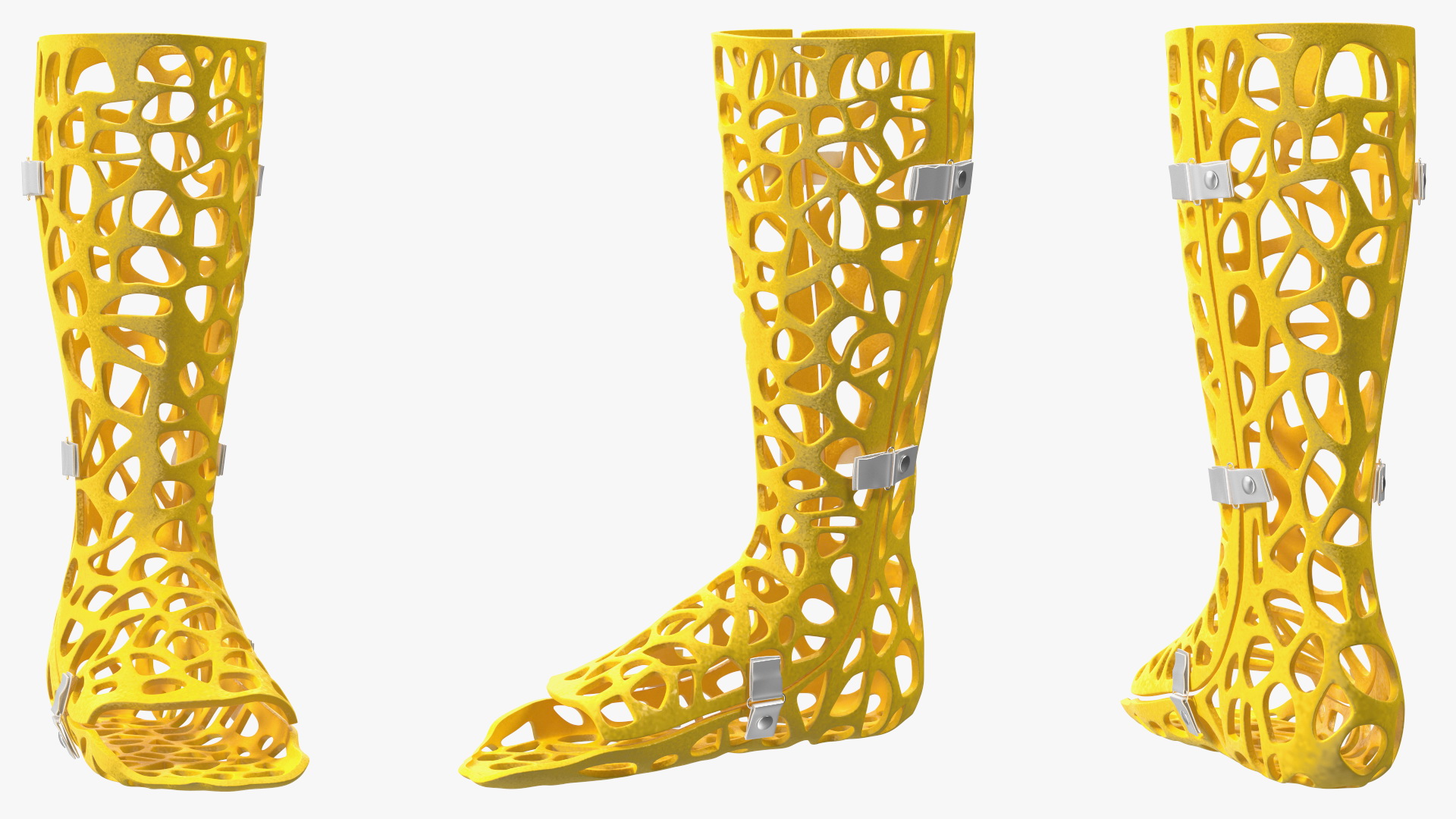 3D-Printed Orthopedic Cast Leg Yellow 3D