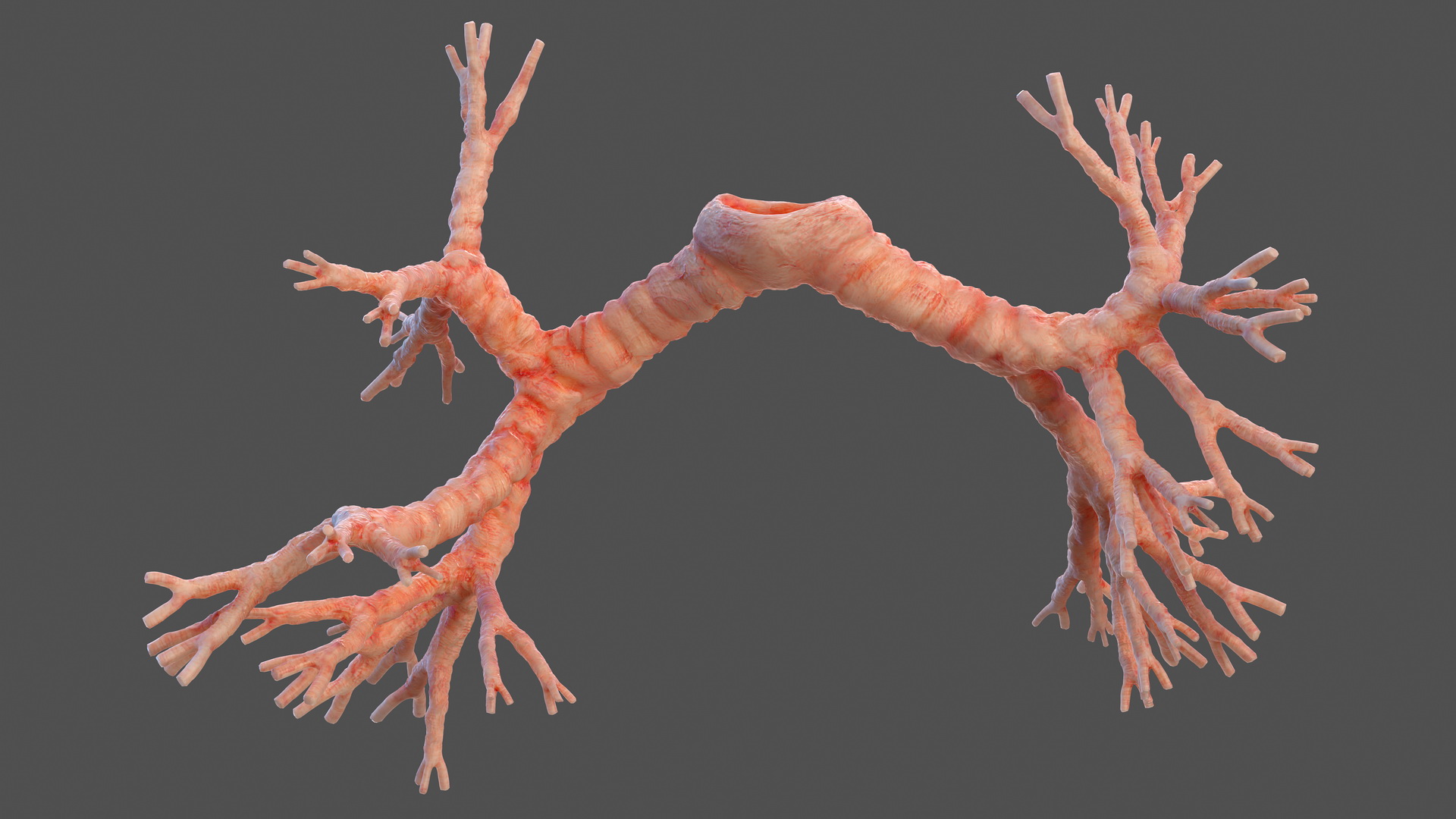 3D Human Bronchi model