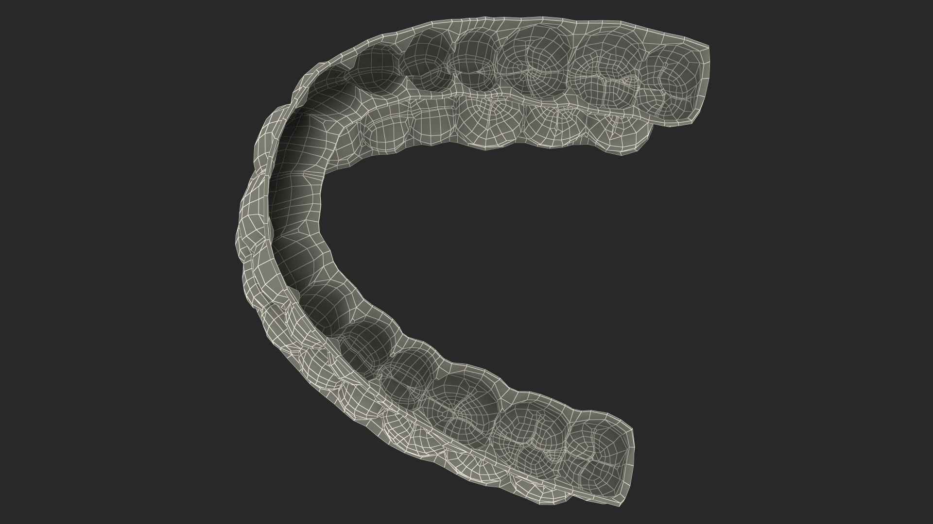 3D Teeth Replacement Retainer