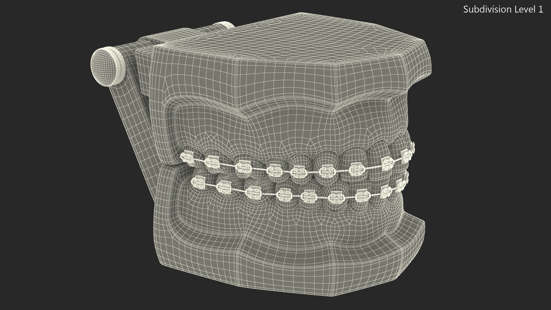 3D model Ligature Braces on Teeth Model