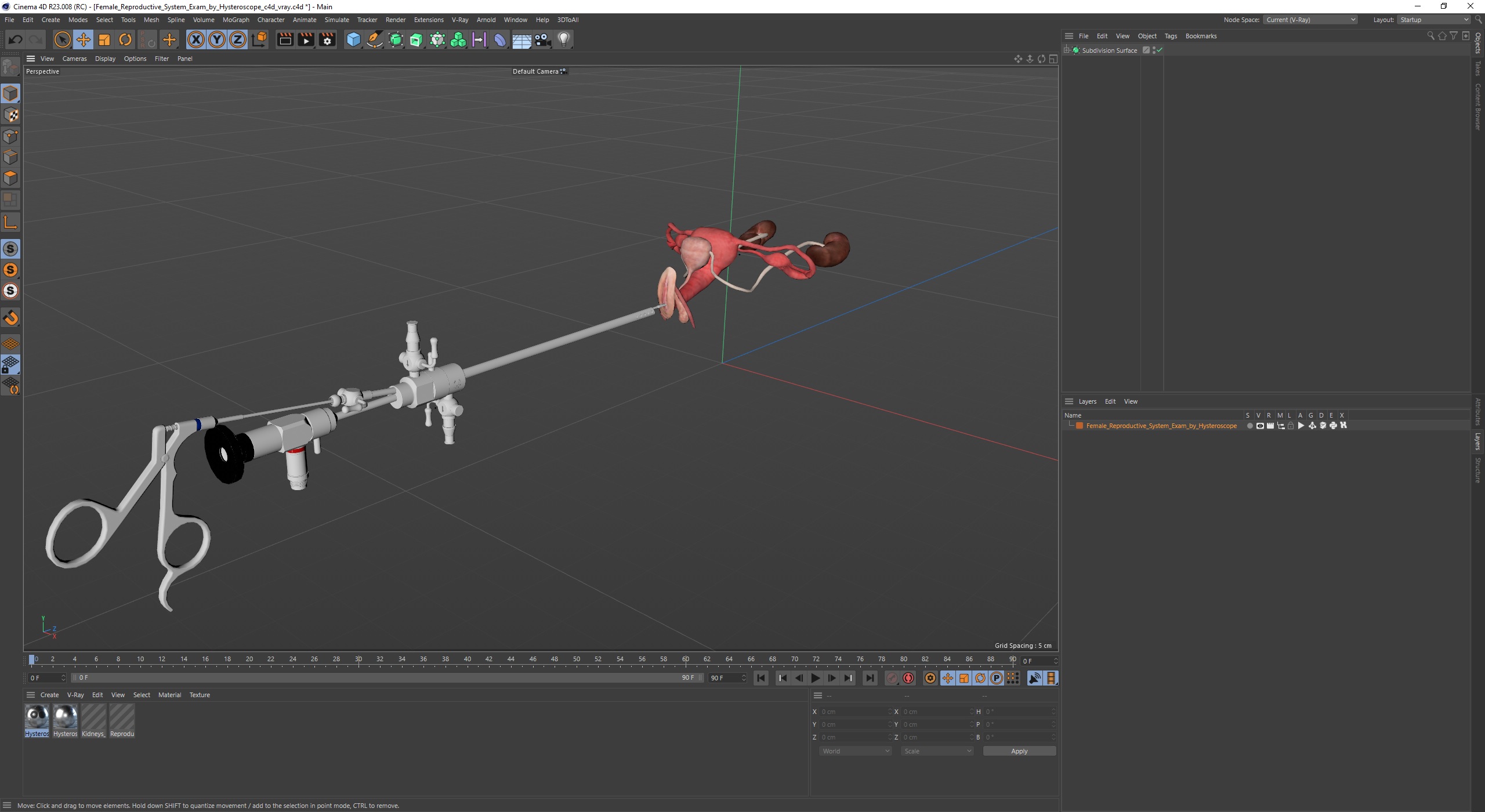 Female Reproductive System Exam by Hysteroscope 3D