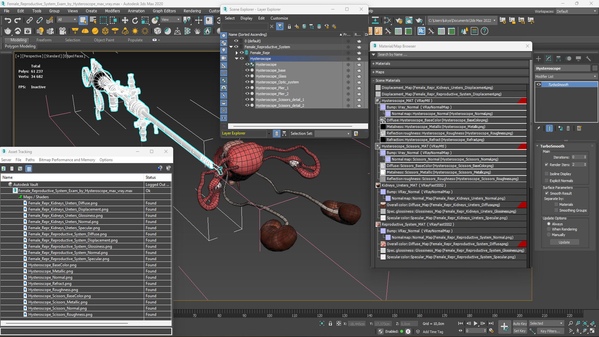 Female Reproductive System Exam by Hysteroscope 3D