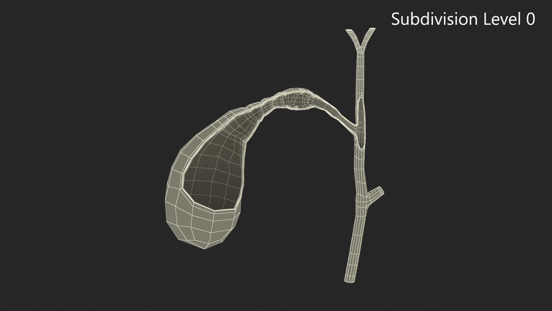 3D Gall Bladder Cut