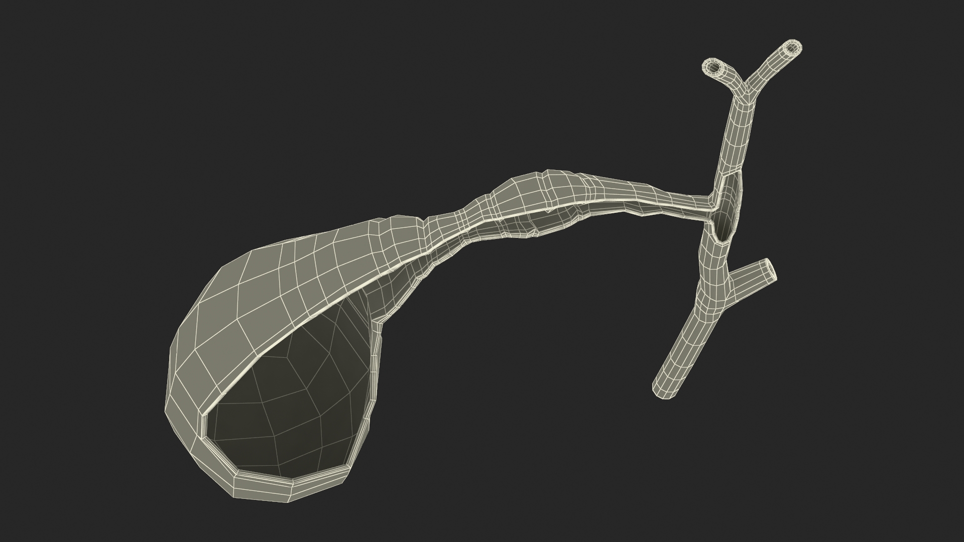 3D Gall Bladder Cut