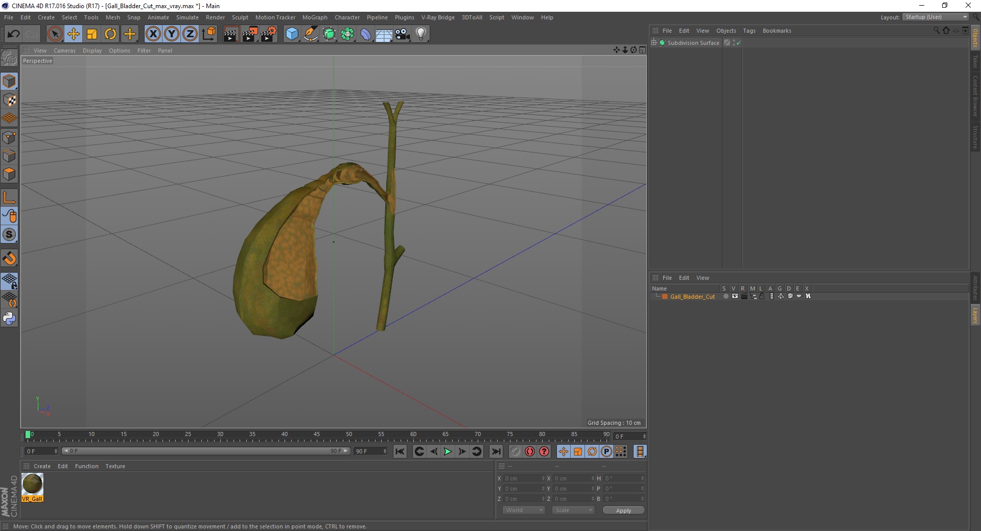 3D Gall Bladder Cut