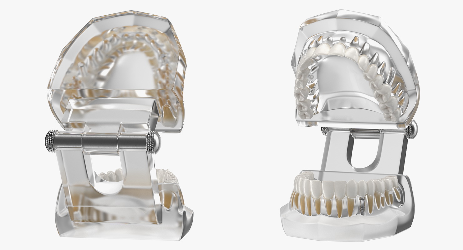 3D Transparent Dental Typodont With Dental Implants model