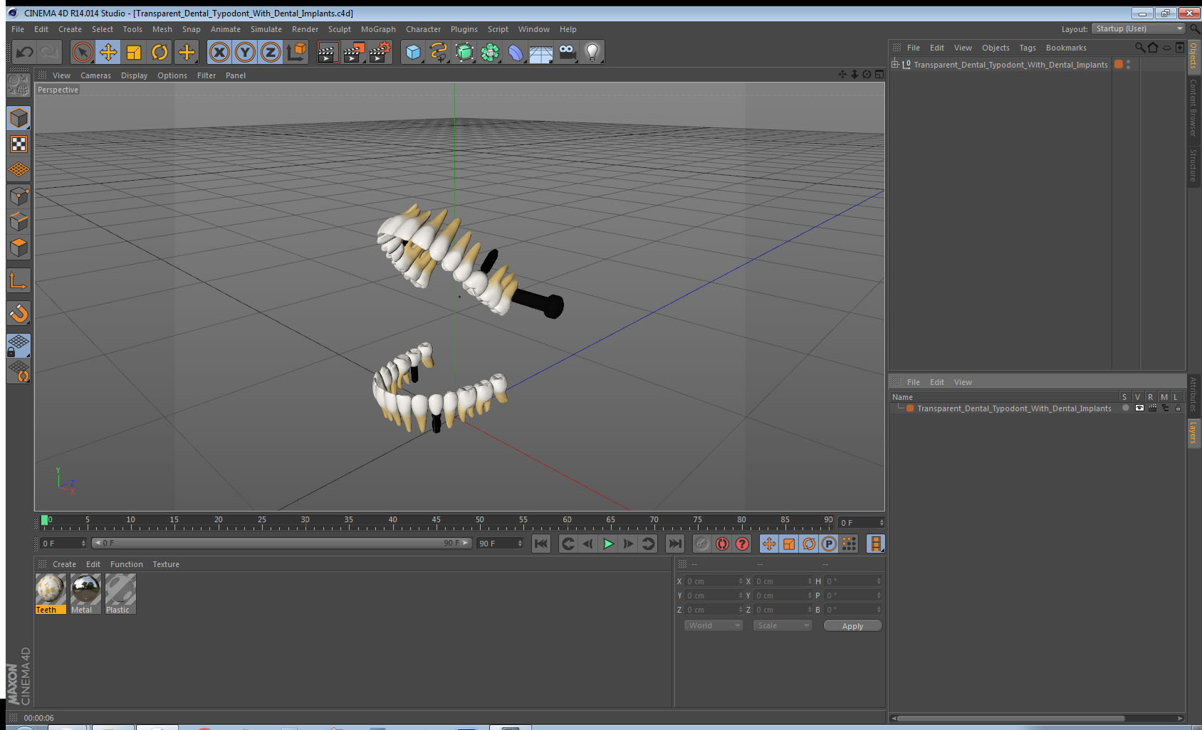 3D Transparent Dental Typodont With Dental Implants model