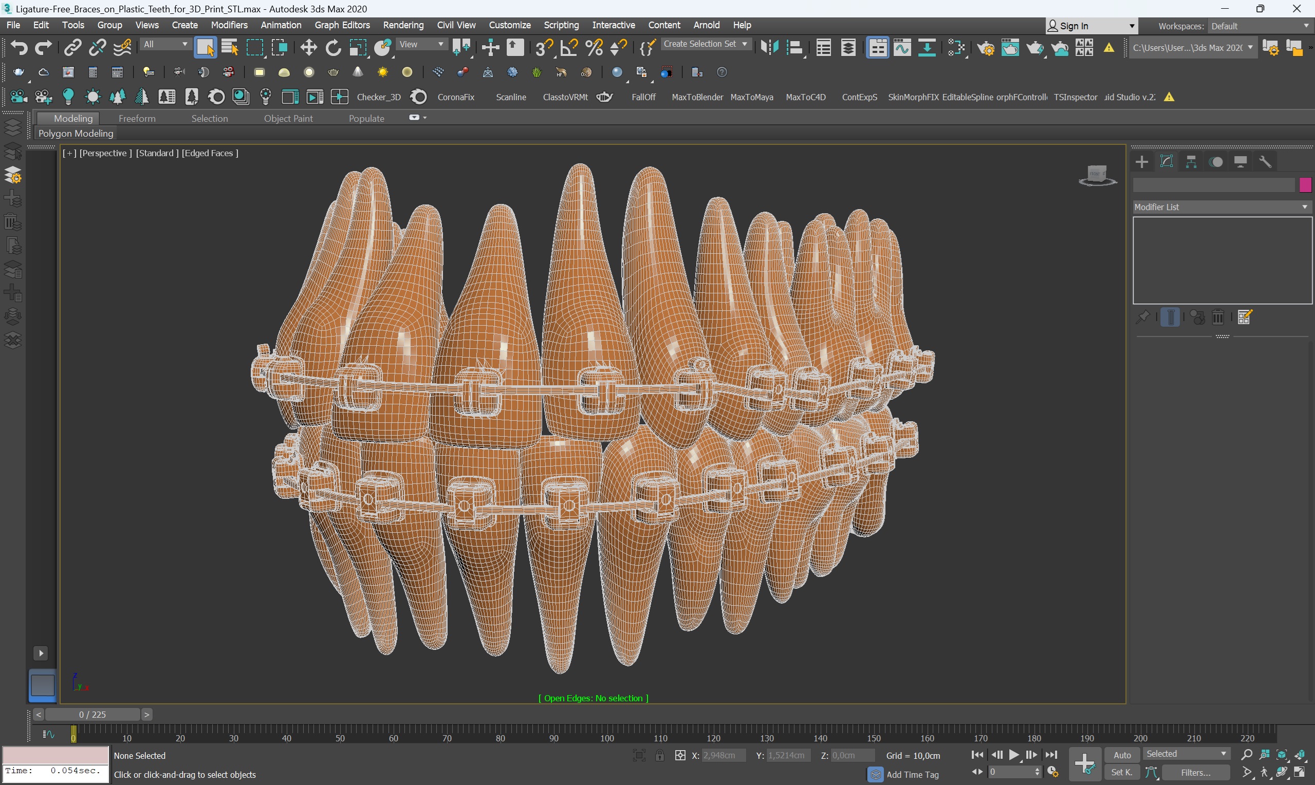 3D model Ligature-Free Braces on Plastic Teeth for 3D Print