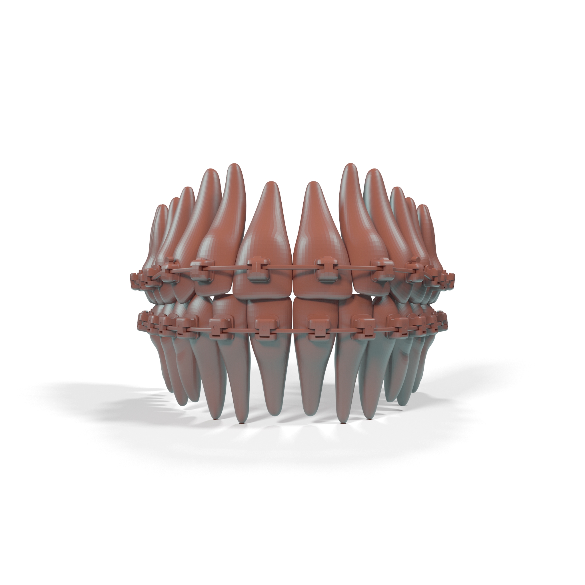 3D model Ligature-Free Braces on Plastic Teeth for 3D Print