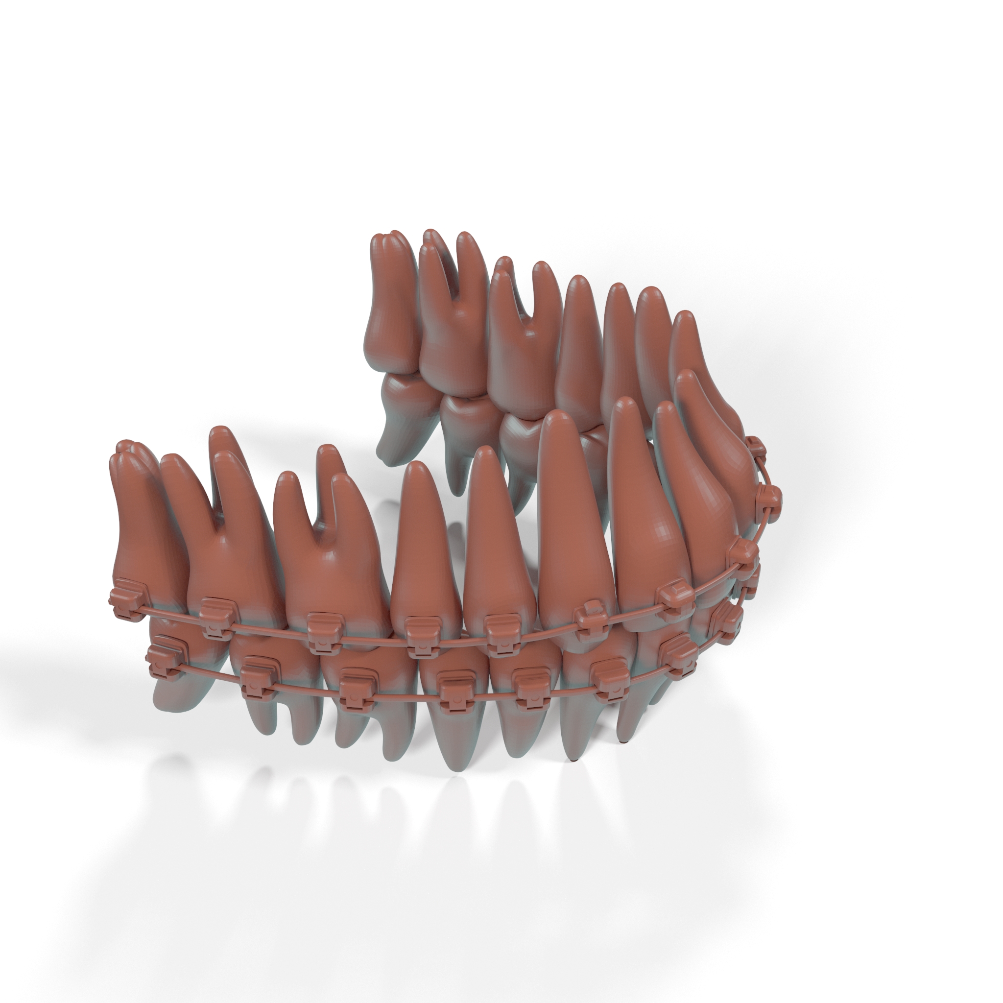 3D model Ligature-Free Braces on Plastic Teeth for 3D Print