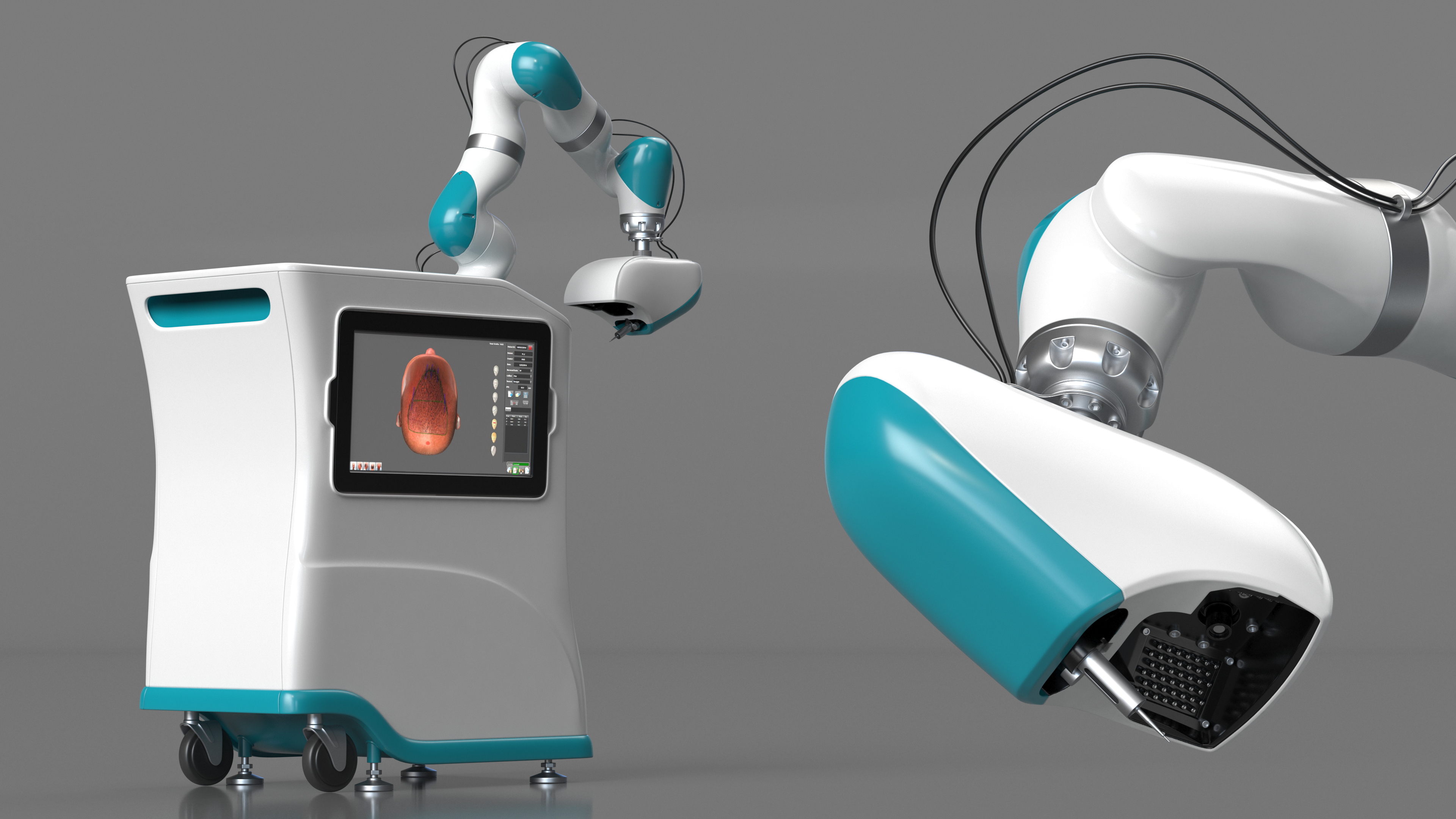 3D Robotic Hair Restoration Rigged