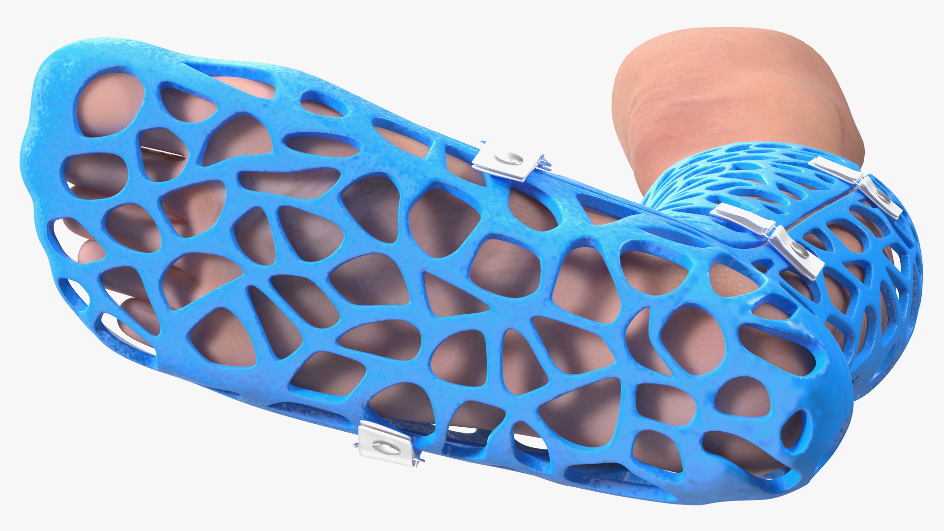 3D 3D-Printed Orthopedic Cast On Leg model