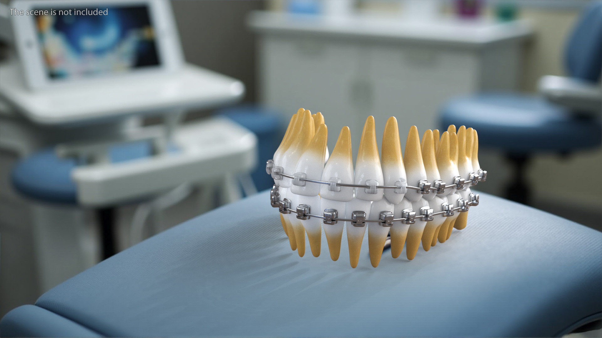 Ligature-Free Braces on Plastic Teeth 3D