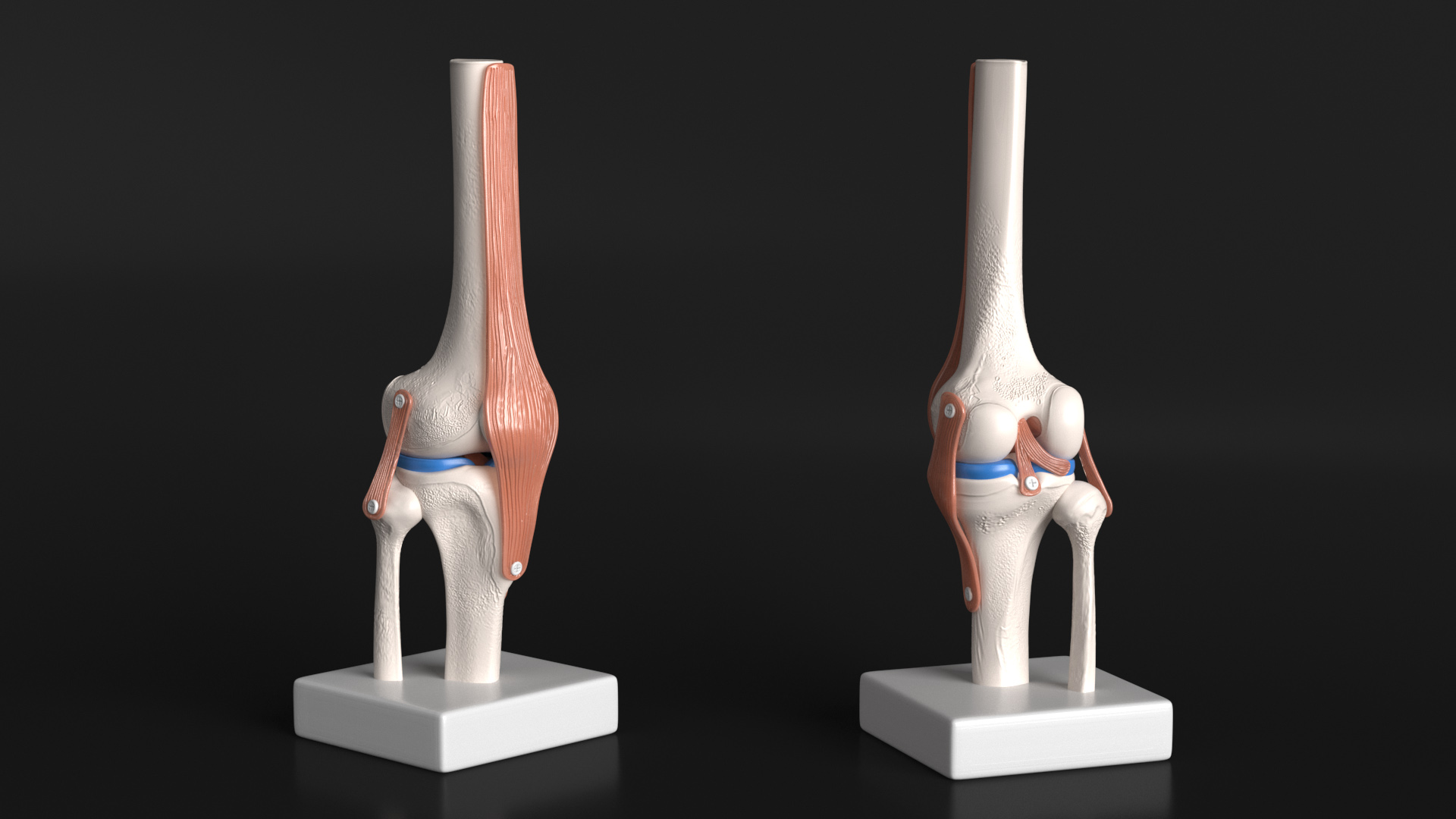 3D Anatomical Model of Knee Joint for 3D Print model