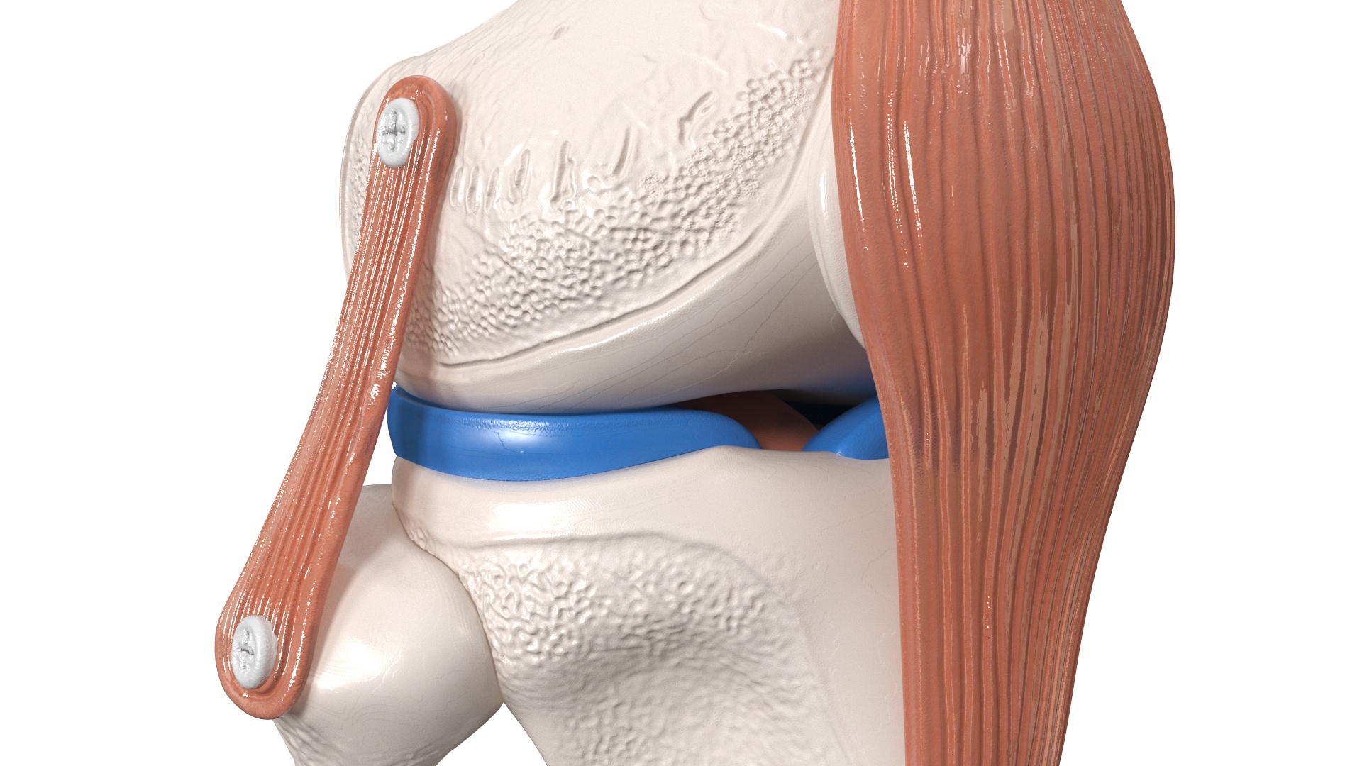 3D Anatomical Model of Knee Joint for 3D Print model