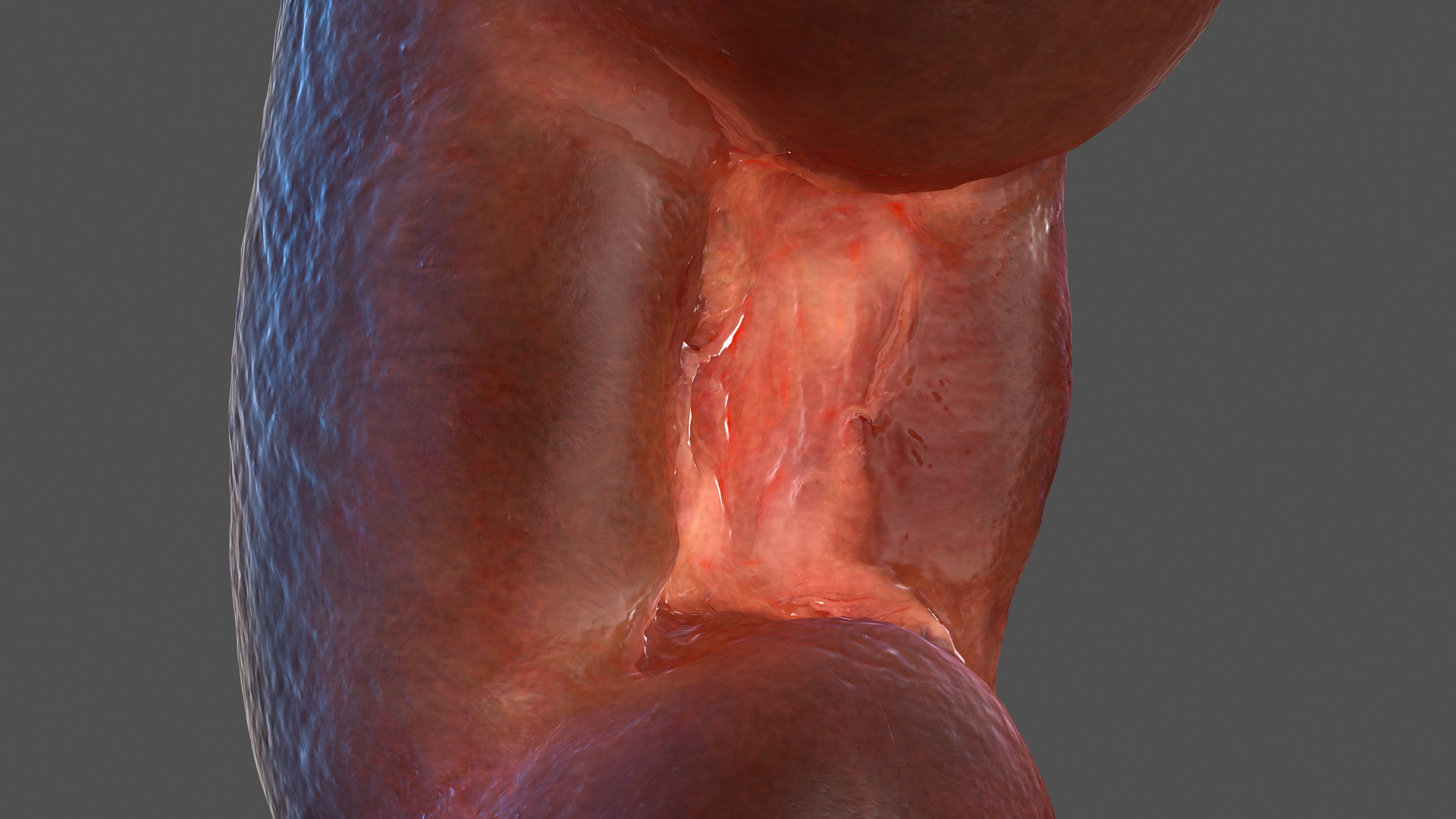 Human Kidney 3D