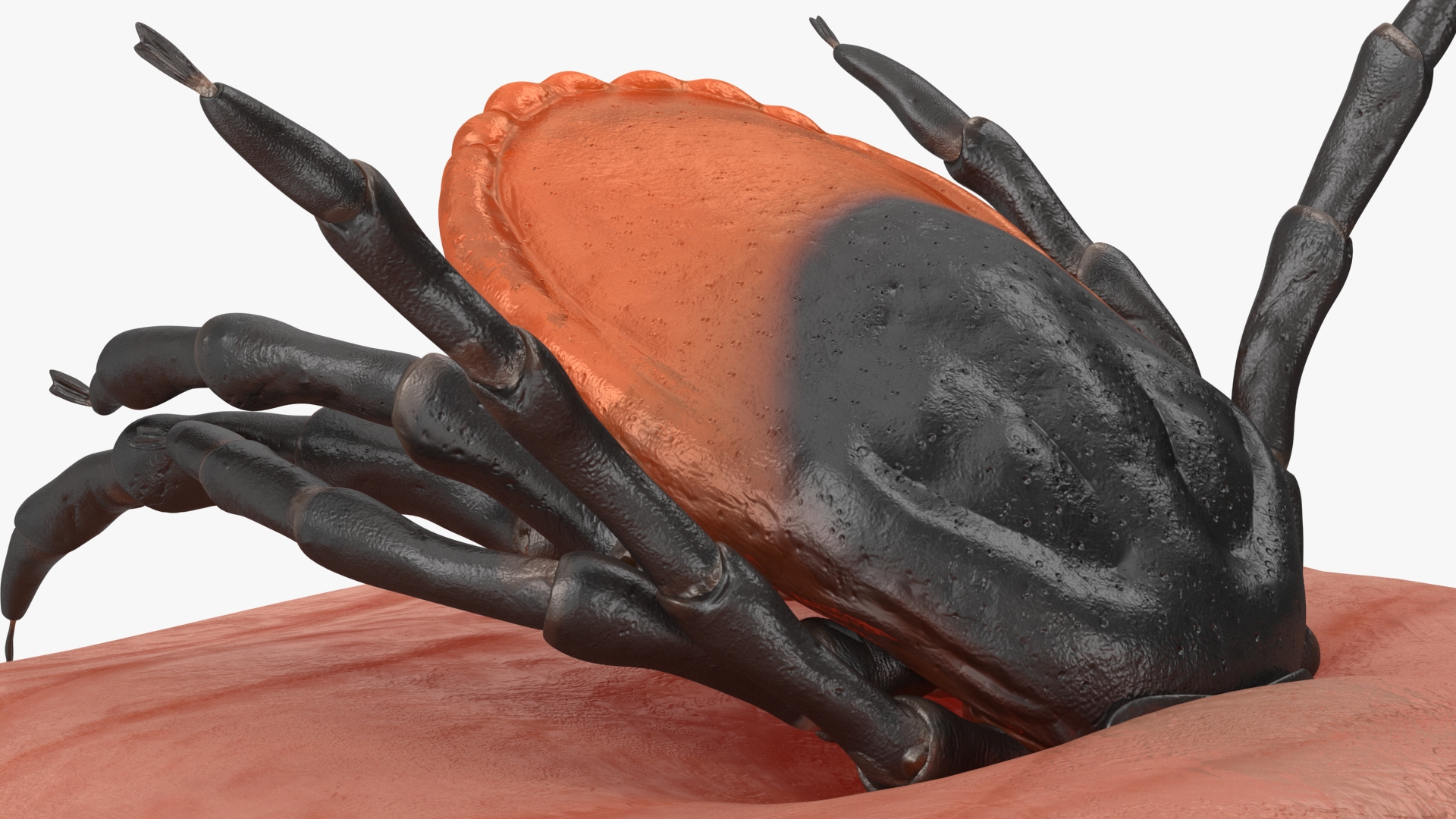 3D Tick Stuck in Skin model