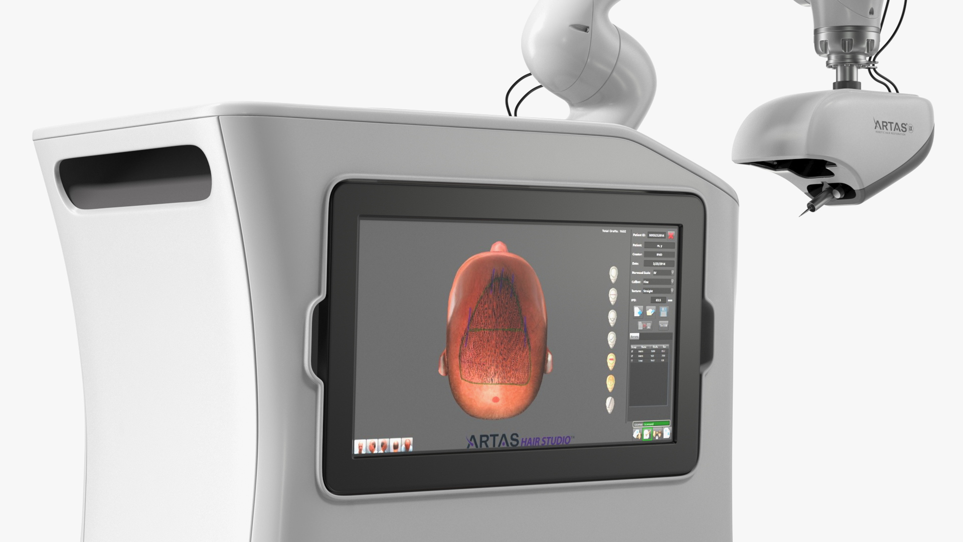 3D model ARTAS Robotic Hair Restoration