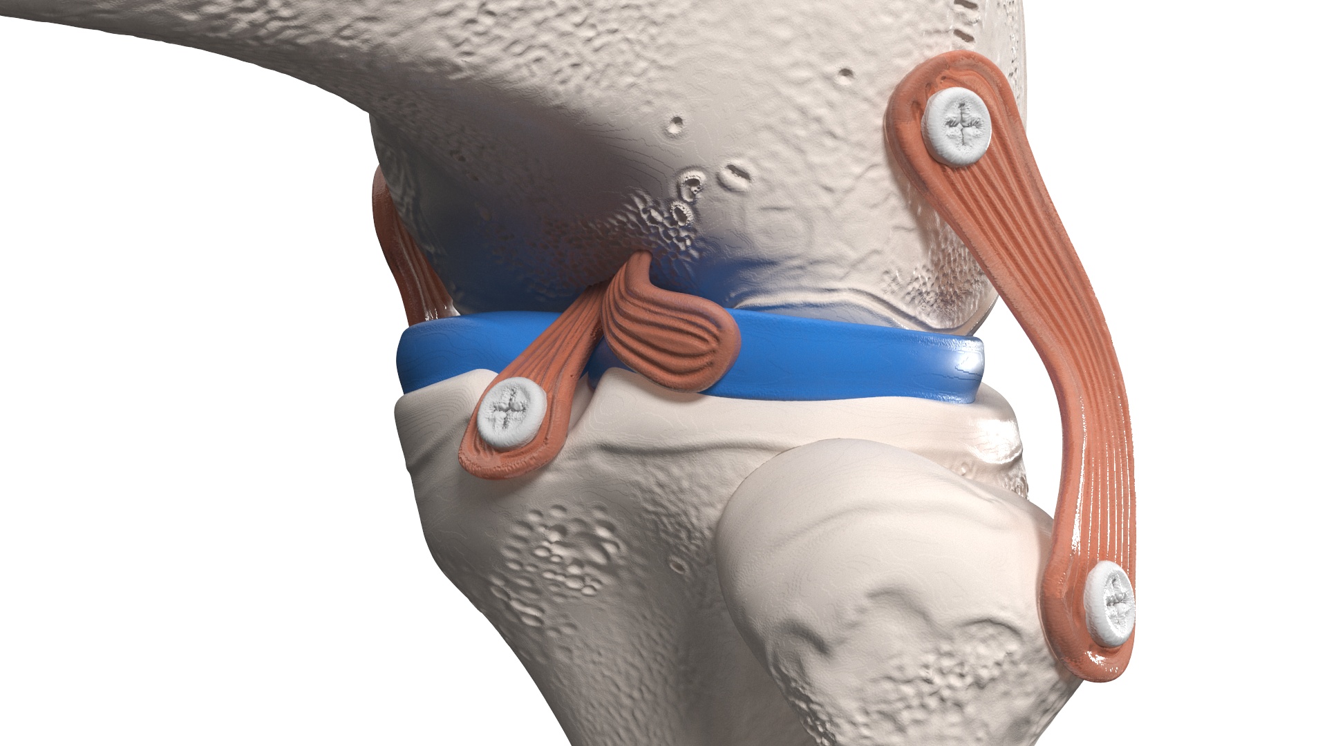 3D model Knee Joint Model in Flexed Position