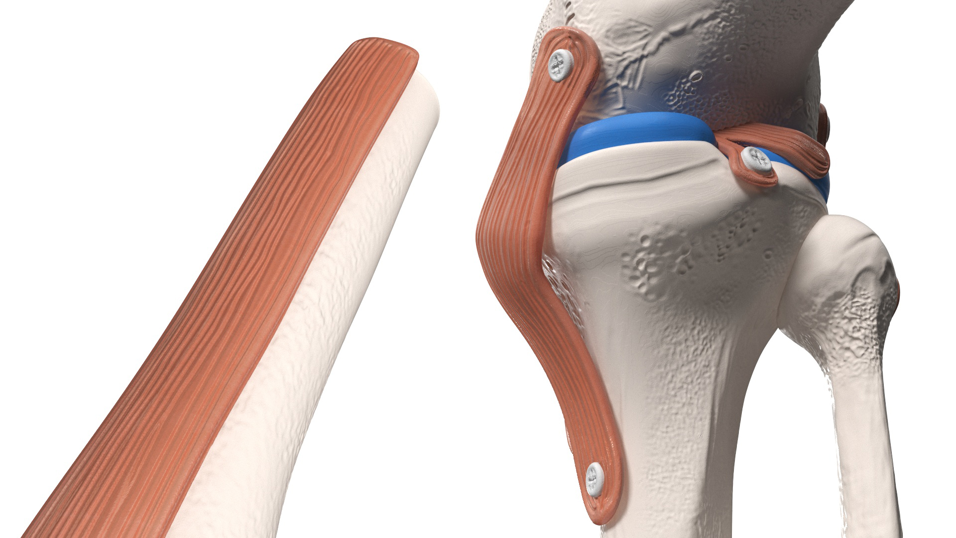 3D model Knee Joint Model in Flexed Position